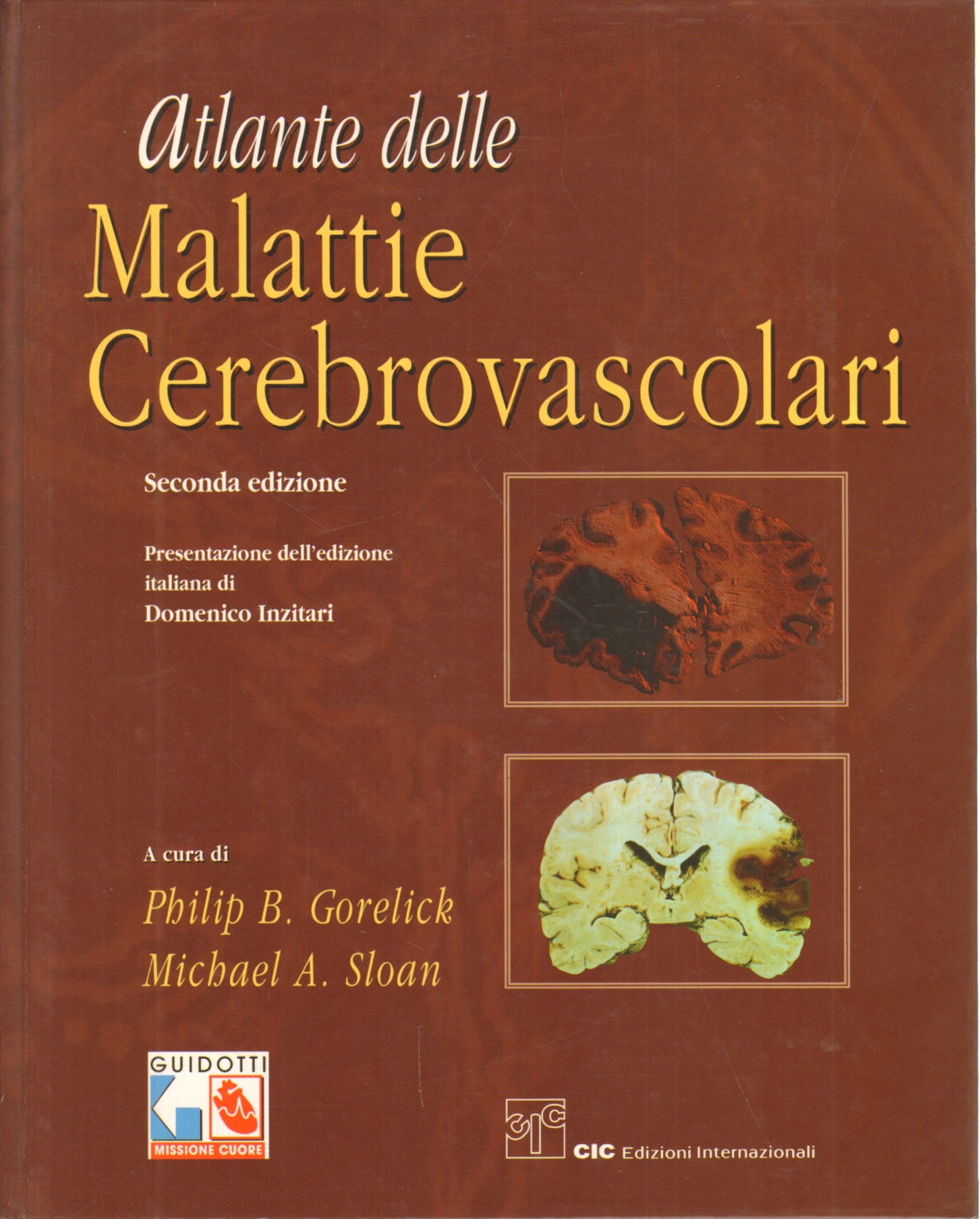 Atlas de la enfermedad cerebrovascular, Philip B. Gorelick y Michael A. Sloan